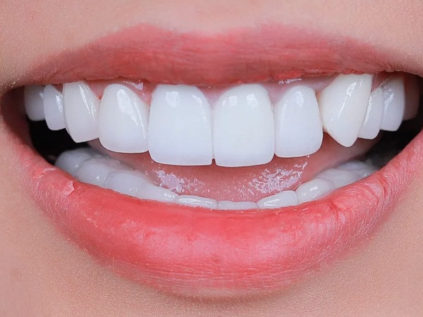 Ngủ mơ thấy răng giả có phải điềm báo xui xẻo?